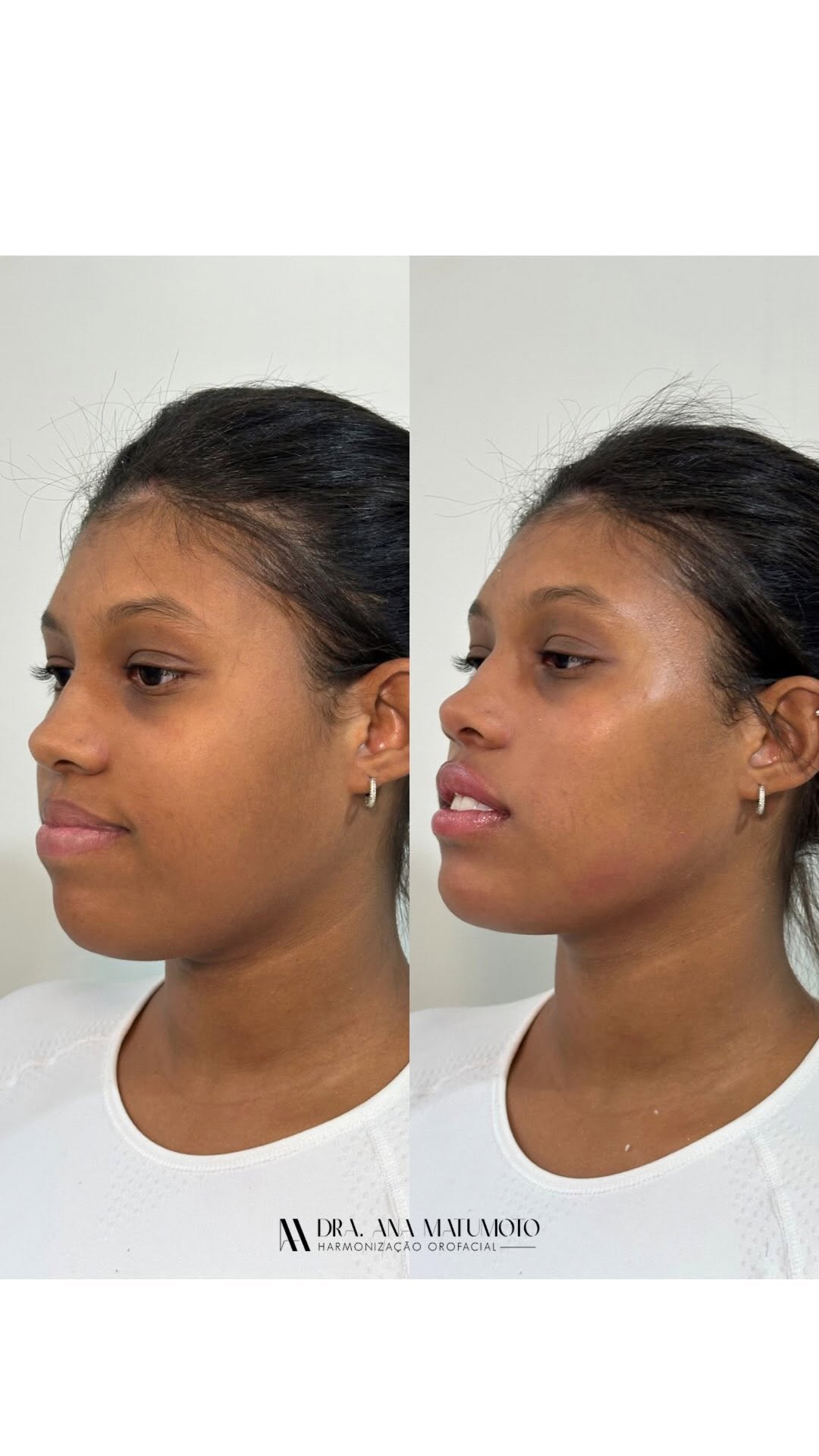 Antes e depois — caso 8